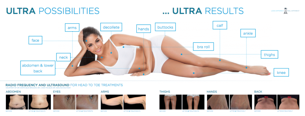 NewBody - Club de Antienvejecimiento / Maquinas de ultima tecnología para esculpir tu cuerpo únicos en colombia / EXILIS BTL / newbodycol.com.co